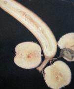 Bananapple's 